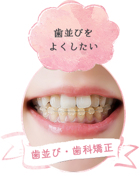 歯科矯正